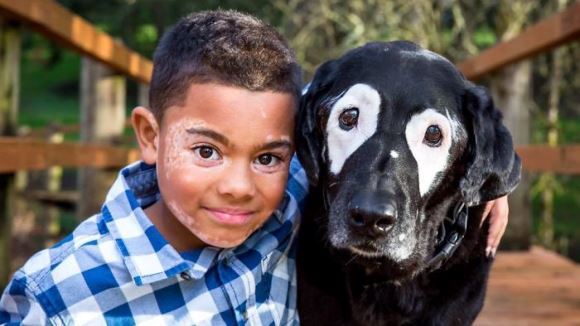 Se ura din cauza condiţiei cronice de care suferea, până ce şi-a întâlnit câinele-geamăn. Povestea impresionantă a unui băieţel bolnav de vitiligo - Galarie foto