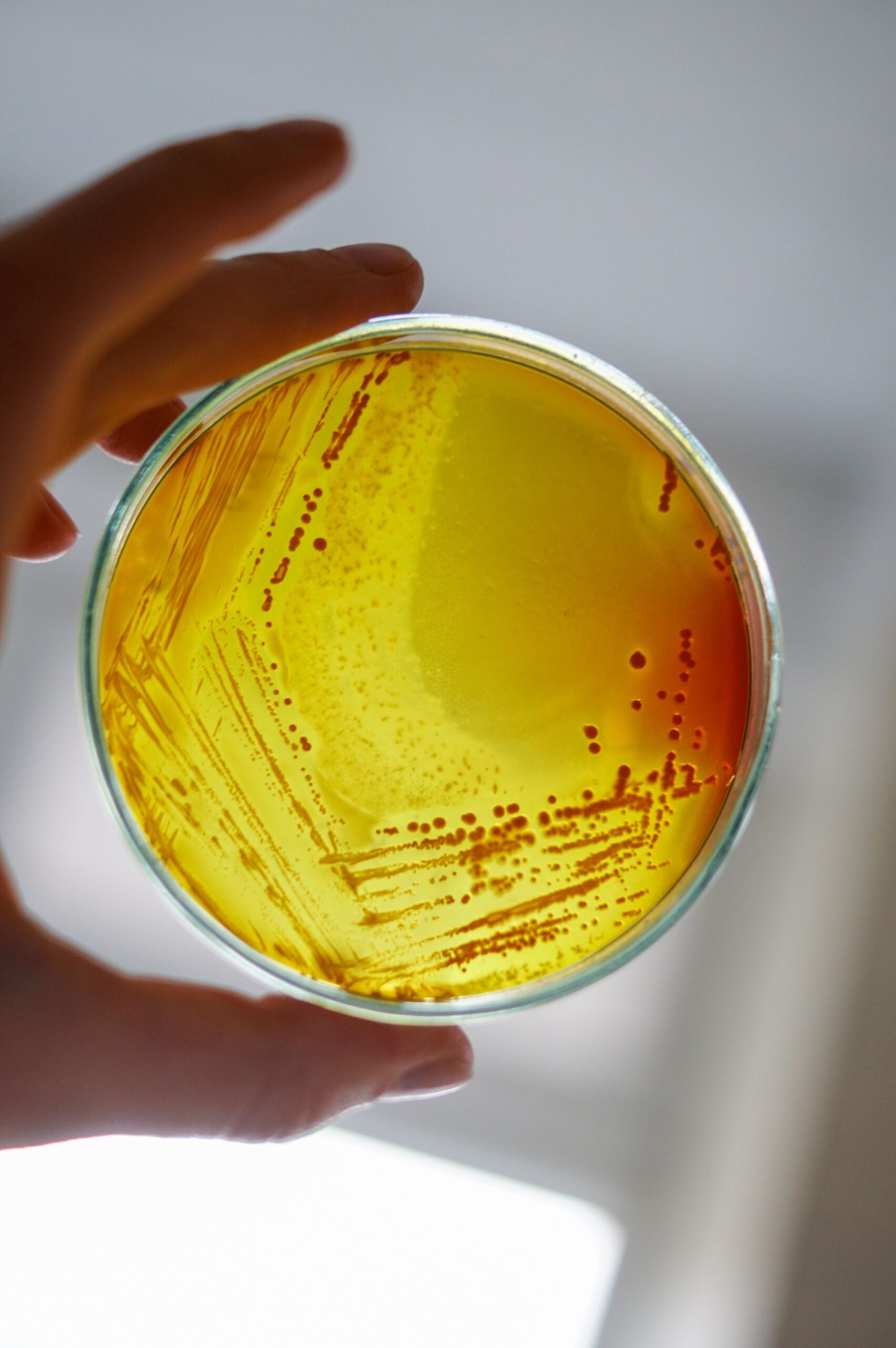 Aceste bacterii pot utiliza uraniul dizolvat în apă ca parte a proceselor metabolice, dacă au la dispoziție glicerină. Foto: pexels.com